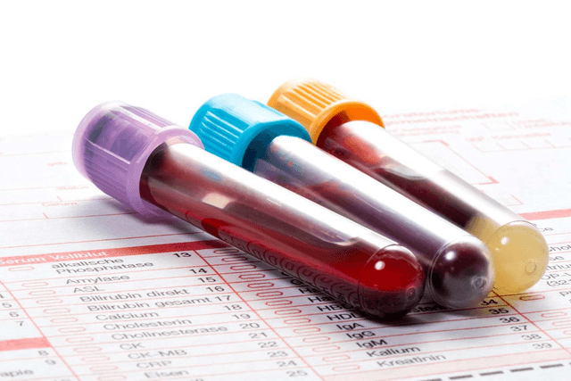 Hemogram analysis with assessment and optimization (1h30)